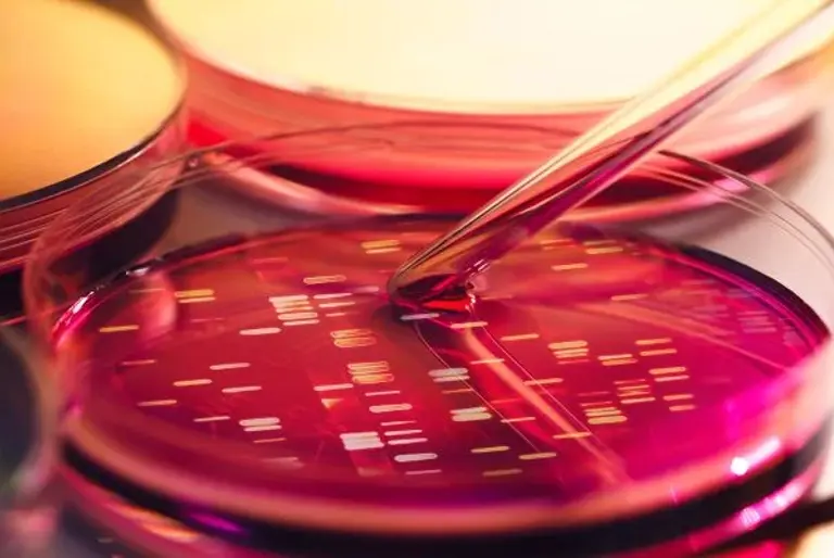 bacteria growing in a petri dish